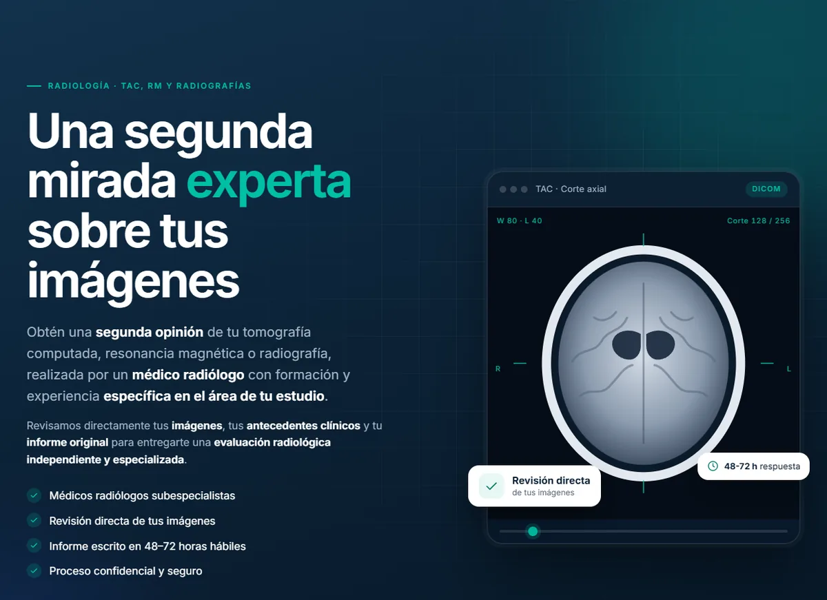 Página de inicio de una plataforma de segunda opinión radiológica, con un visor de imágenes de tomografía